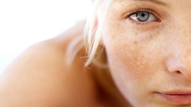 Pigment verwijderen - New Skin Laserclinic
