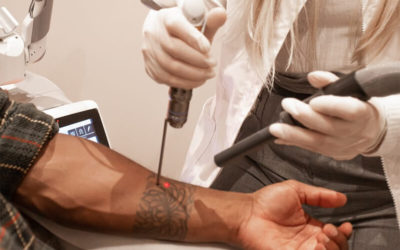 Cost and treatments tattoo removal