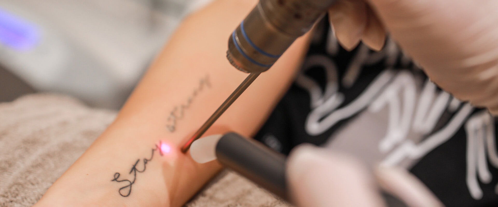 nazorg tattoo verwijderen