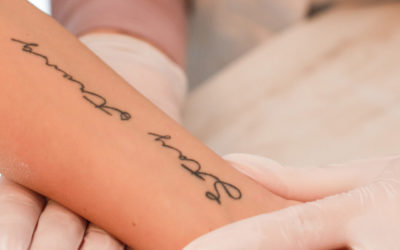 How long does tattoo removal take