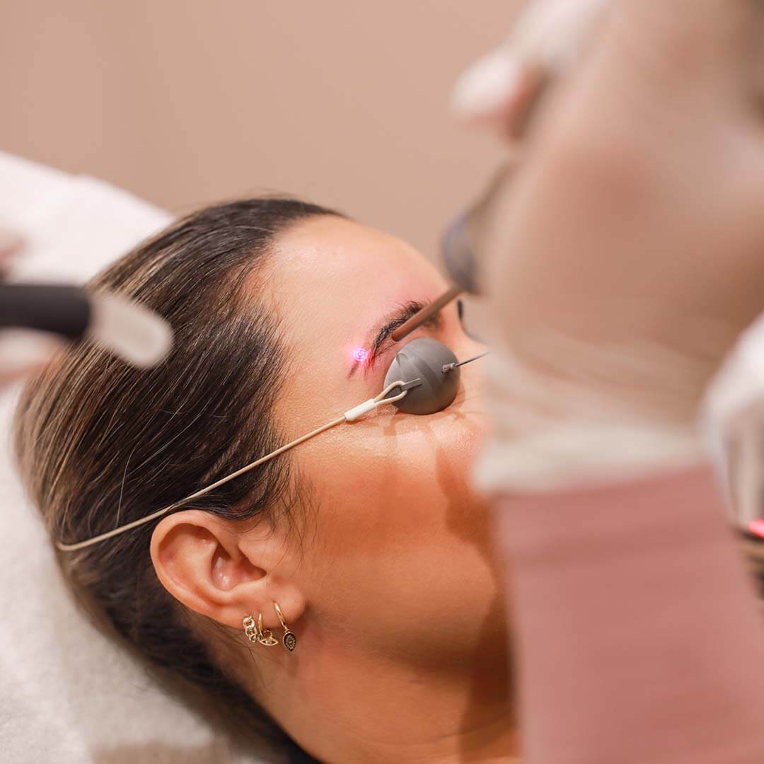 New-Skin-Laser-Clinic_Fotoshoot_1080x1080_105