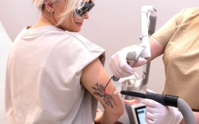 Aftercare tattoo lasering