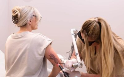 Tattoo removal in summer