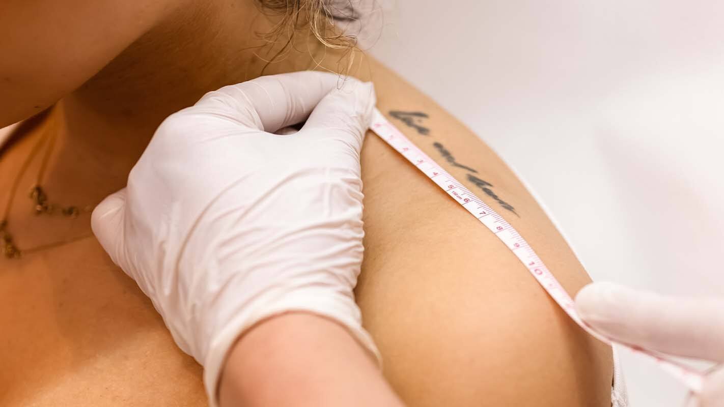 Lelijke tattoo? Wat doe je er mee cover